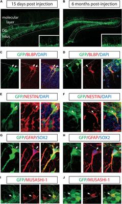 Long-Term Labeling of Hippocampal Neural Stem Cells by a Lentiviral Vector